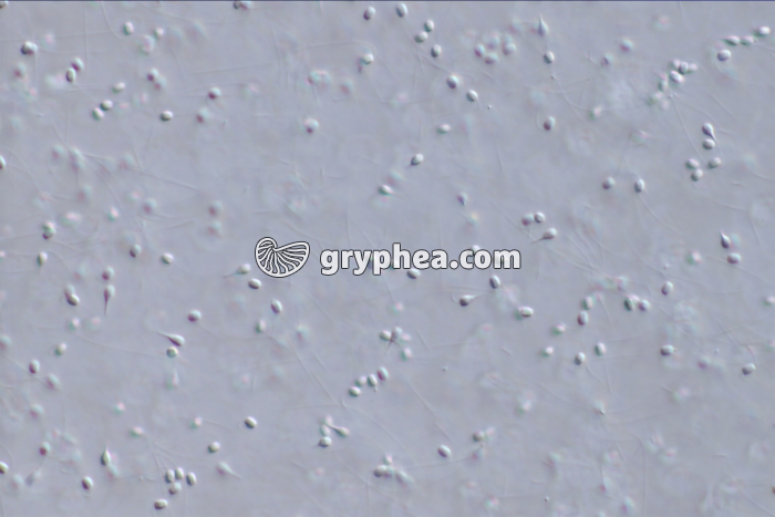 Spermatozoides de Moule (Mytilus edulis) x120 - gryphea.org